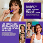 SMILEKIT | Cintas Blanqueadoras