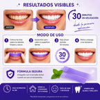 SMILEKIT | Cintas Blanqueadoras
